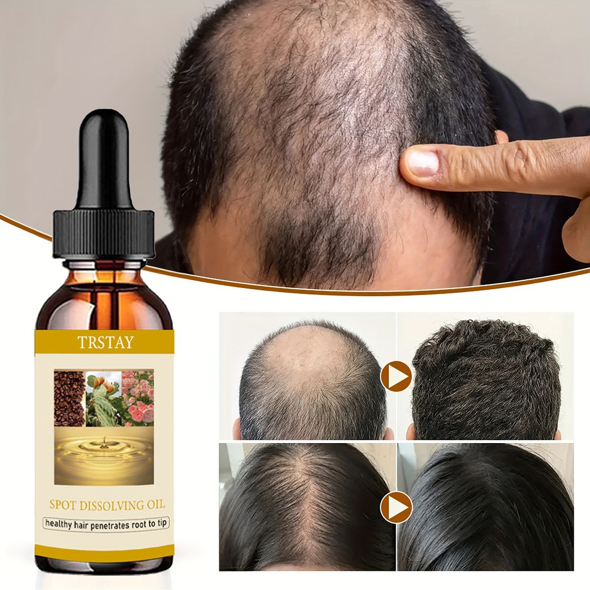 Beard Oil Growth - 50 ml Bartwachstumsöl, Anti-Alopezie, ätherische Öle