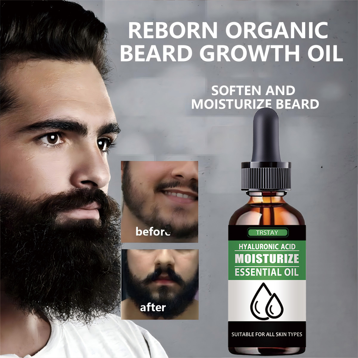 100 % natürliches, beschleunig – Beard Oil Growth Bewertung und Preis