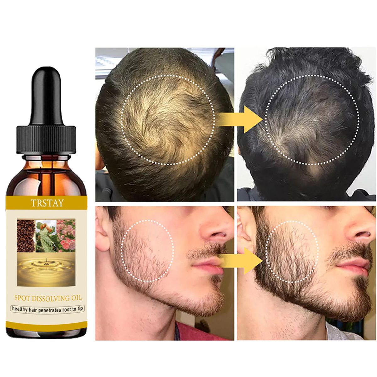 50 ml Bartwachstumsöl, Anti-Al – Beard Oil Growth Bewertung und Preis