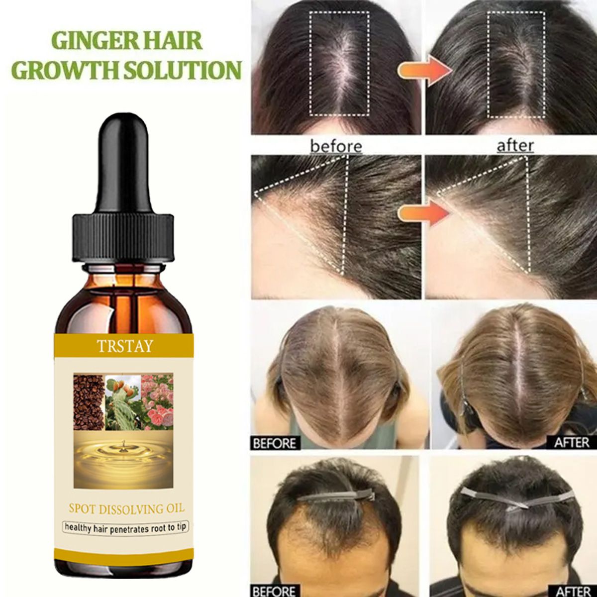 50 ml Bartwachstumsöl, Anti-Al – Beard Oil Growth Bewertung und Preis