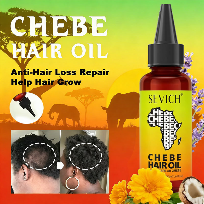 Chebe Schnelles Haarwuchsöl Af – Beard Oil Growth Bewertung und Preis