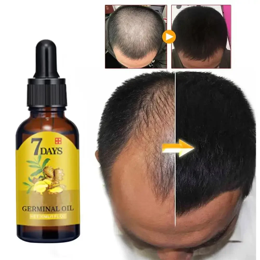 Haarwachstums-Ingwer, schnell  – Beard Oil Growth Bewertung und Preis