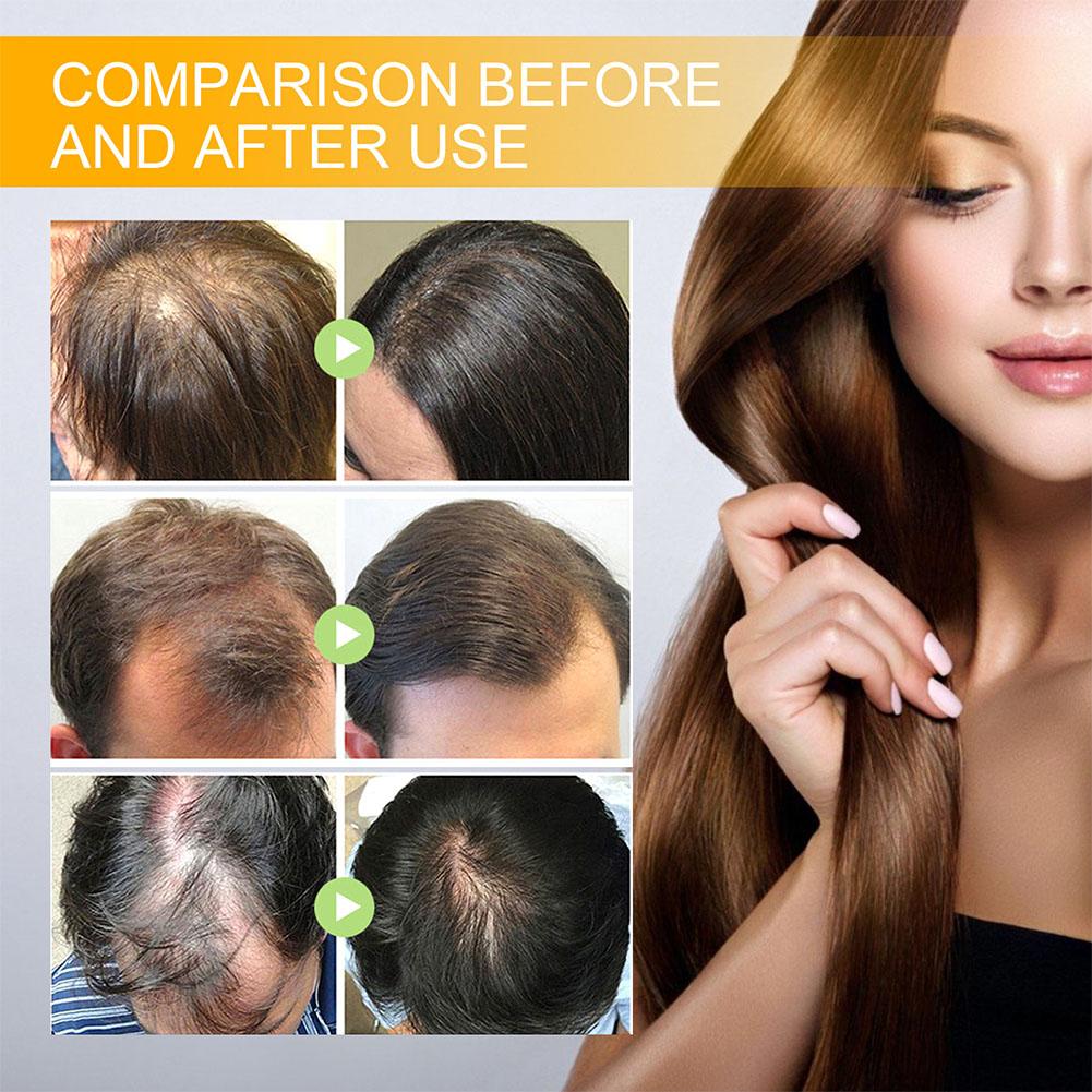 5/3/1 stücke Biotin Schnelle H – Beard Oil Growth Bewertung und Preis